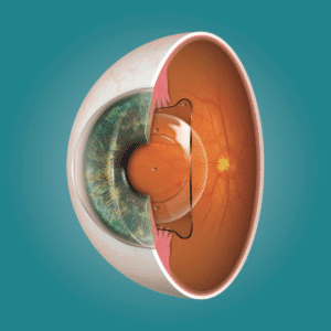 ⁠best eye hospital in Jalandhar