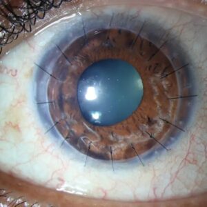 ⁠best eye hospital in Jalandhar