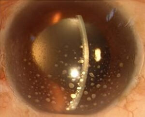 ⁠best eye hospital in Jalandhar