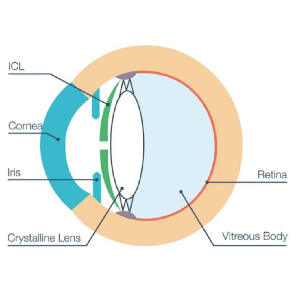 ⁠best eye hospital in Jalandhar