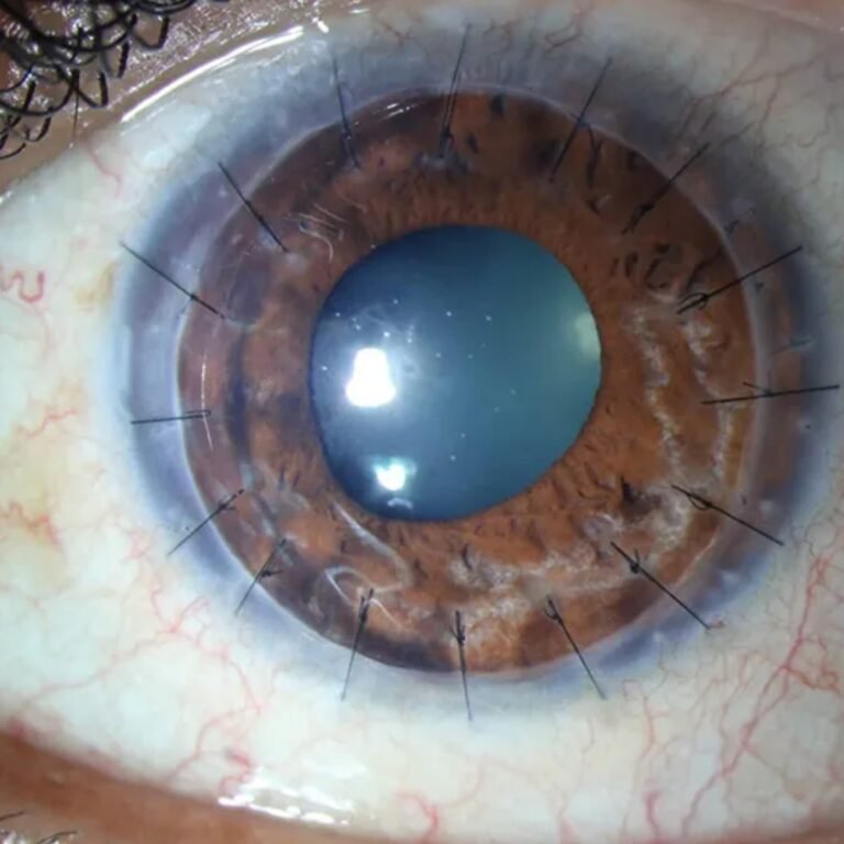 best eye hospital in Jalandhar