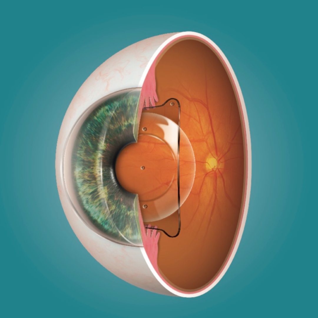 best eye hospital in Jalandhar