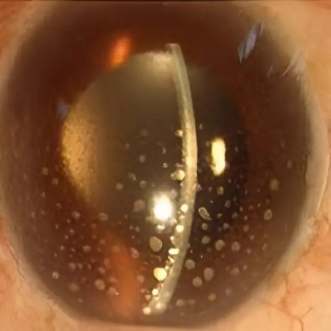 best eye hospital in Jalandhar