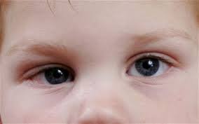 Lazy Eye Treatment In Jalandhar