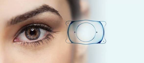 ICL Surgery Cost in Jalandhar?